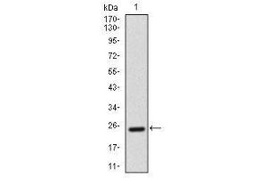 Image no. 2 for anti-Activated Leukocyte Cell Adhesion Molecule (ALCAM) antibody (ABIN1491488)