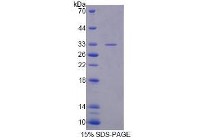 SDS-PAGE analysis of Human XPO4 Protein. (XPO4 Protéine)