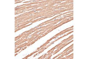 Immunohistochemistry of paraffin-embedded rat heart using KIF4A antibody (ABIN6128156, ABIN6142873, ABIN6142874 and ABIN6214349) at dilution of 1:100 (40x lens).