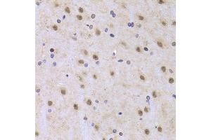 Immunohistochemistry of paraffin-embedded rat brain using ILF2 Antibody (ABIN5973487) at dilution of 1/100 (40x lens). (ILF2 anticorps)