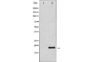 Western blot analysis of Synuclein expression in HuvEc whole cell lysates,The lane on the left is treated with the antigen-specific peptide. (SNCA anticorps  (C-Term))