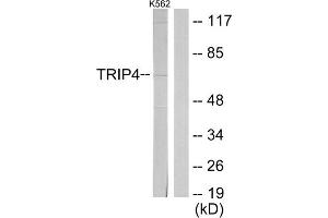 Western blot analysis of extracts from K562 cells, using TRIP4 antibody. (TRIP4 anticorps  (Internal Region))