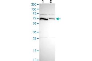 Western blot analysis of Lane 1: Human cell line RT-4 Lane 2: Human cell line U-251MG sp with PCK2 polyclonal antibody  at 1:250-1:500 dilution. (PEPCK anticorps)