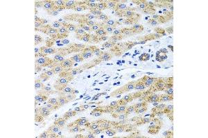 Immunohistochemistry of paraffin-embedded human liver injury using PEX14 antibody.