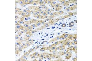 Immunohistochemistry of paraffin-embedded human liver injury using PEX14 antibody. (PEX14 anticorps  (AA 118-377))