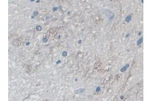 Detection of MYO1D in Rat Spinal cord Tissue using Polyclonal Antibody to Myosin ID (MYO1D) (Myosin ID anticorps  (AA 512-788))