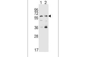 Western blot analysis in Hela(lane 1),K562(lane 2) cell line lysates (35ug/lane). (SLC22A4 anticorps  (C-Term))
