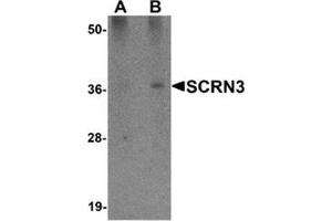 Western blot analysis of SCRN3 in 293 cell tissue lysate with SCRN3 antibody at (A) 1 and (B) 2 μg/ml.