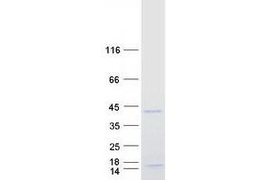 Validation with Western Blot