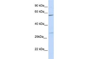 WB Suggested Anti-PRPS2 Antibody Titration:  0. (PRPS2 anticorps  (N-Term))