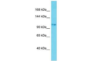 Host: Rabbit Target Name: SKIDA1 Sample Type: Jurkat Whole Cell lysates Antibody Dilution: 1. (SKIDA1 anticorps  (C-Term))
