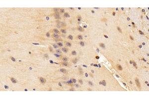 Detection of NGF in Rat Cerebrum Tissue using Polyclonal Antibody to Nerve Growth Factor (NGF) (Nerve Growth Factor anticorps  (AA 19-241))