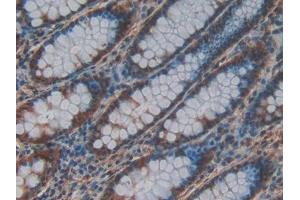 DAB staining on IHC-P; Samples: Human Rectum Tissue (CRAF anticorps  (AA 342-619))