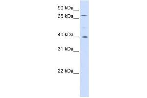 SPATA7 antibody used at 1 ug/ml to detect target protein. (SPATA7 anticorps  (Middle Region))