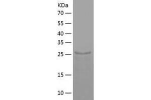 Western Blotting (WB) image for Defective in Cullin Neddylation 1, Domain Containing 1 (DCUN1D1) (AA 1-259) protein (His-IF2DI Tag) (ABIN7122613)