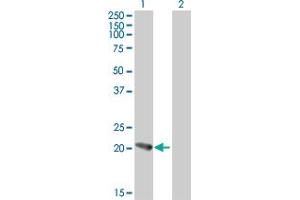 Western Blot analysis of PFDN5 expression in transfected 293T cell line by PFDN5 MaxPab polyclonal antibody. (PFDN5 anticorps  (AA 1-154))
