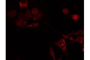 ABIN6275245 staining HeLa by IF/ICC. (MRPL49 anticorps  (Internal Region))