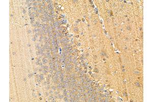 ABIN6256183 and ABIN6267191 at 1/100 staining Rat brain tissue by IHC-P.