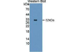 Detection of Recombinant CTNNa1, Human using Polyclonal Antibody to Catenin Alpha 1 (CTNNa1) (CTNNA1 anticorps  (AA 2-228))