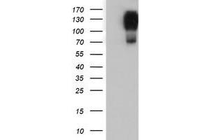HEK293T cells were transfected with the pCMV6-ENTRY control (Left lane) or pCMV6-ENTRY ENPEP (Right lane) cDNA for 48 hrs and lysed. (ENPEP anticorps)