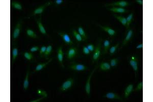 Immunofluorescence staining of Hela cells with ABIN7152355 at 1:166, counter-stained with DAPI. (EYA1 anticorps  (AA 168-321))