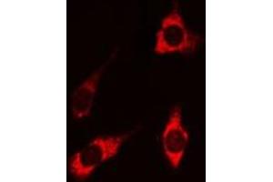 ABIN6269202 staining HEK 293 cells by IF/ICC. (PI3K p85 alpha/gamma anticorps)