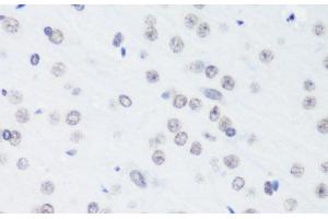 Immunohistochemistry of paraffin-embedded Rat brain using TriMethyl-Histone H3-K64 Polyclonal Antibody at dilution of 1:100 (40x lens).