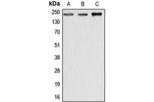 Western blot analysis of Dysferlin expression in MCF7 (A), SP2/0 (B), rat liver (C) whole cell lysates. (Dysferlin anticorps  (C-Term))