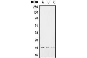 Western blot analysis of SNX3 expression in A2058 (A), Raw264.