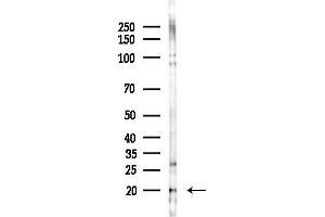 anti-DnaJ (Hsp40) Homolog, Subfamily C, Member 24 (DNAJC24) antibody