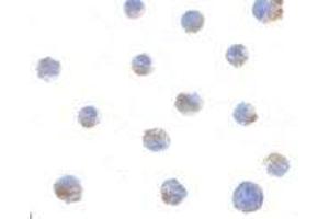 Immunocytochemistry of BIK in Jurkat cells with AP30150PU-N BIK antibody at 1 μg/ml.