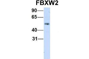Host:  Rabbit  Target Name:  FBXW2  Sample Type:  Human Fetal Lung  Antibody Dilution:  1.