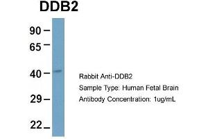 Host: Rabbit  Target Name: DDB2  Sample Tissue: Human Fetal Brain  Antibody Dilution: 1.