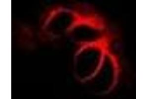 anti-Charged Multivesicular Body Protein 2B (CHMP2B) antibody