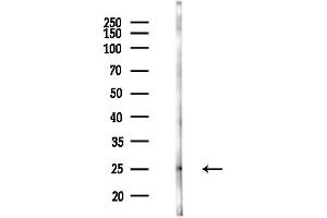 Western blot analysis of lysates from Mouse brain, using PSM Antibody at 1/1000 dilution.
