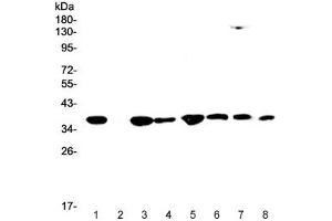 Western blot testing of human 1) HeLa, 2) placenta, 3) SW620, 4) PANC-1, 5) HepG2, 6) A549, 7) rat RH35 and 8) mouse HEPA1-6 lysate with SMN1/2 antibody at 0. (SMN1 / SMN2 anticorps)