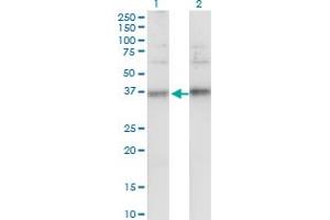 Western Blot analysis of TSPAN32 expression in transfected 293T cell line by TSPAN32 monoclonal antibody (M02), clone 2B4. (TSPAN32 anticorps  (AA 194-290))