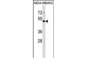 STAC Antibody (C-term) (ABIN1537013 and ABIN2849881) western blot analysis in MDA-M cell line lysates (35 μg/lane). (STAC anticorps  (C-Term))