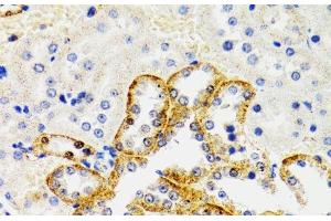Immunohistochemistry of paraffin-embedded Rat kidney using SH2B1 Polyclonal Antibody at dilution of 1:100 (40x lens). (SH2B1 anticorps)