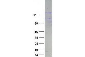 Validation with Western Blot (NFATC4 Protein (Transcript Variant 1) (Myc-DYKDDDDK Tag))
