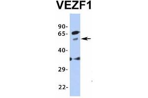 Host:  Rabbit  Target Name:  VEZF1  Sample Type:  Human Fetal Brain  Antibody Dilution:  1.