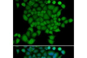 Immunofluorescence analysis of U2OS cells using NEDD9 Polyclonal Antibody (NEDD9 anticorps)