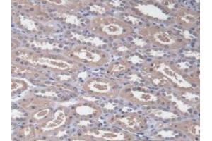 Detection of RDX in Human Kidney Tissue using Polyclonal Antibody to Radixin (RDX)