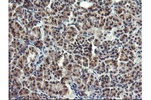 anti-Lysozyme (LYZ) antibody