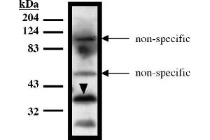 Western Blotting (WB) image for anti-HIR Histone Cell Cycle Regulation Defective Homolog A (HIRA) (AA 1-200), (N-Term) antibody (ABIN264454) (HIRA anticorps  (N-Term))