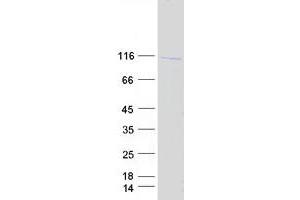 Validation with Western Blot