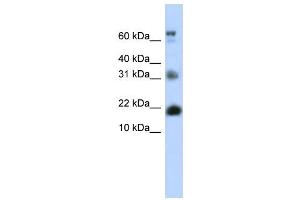 WB Suggested Anti-BUD31 Antibody Titration:  0. (BUD31 anticorps  (N-Term))