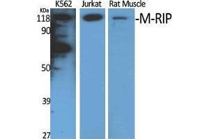 Western Blot (WB) analysis of specific cells using M-RIP Polyclonal Antibody. (MPRIP anticorps  (Internal Region))