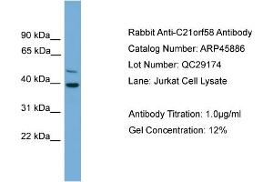 WB Suggested Anti-C21orf58  Antibody Titration: 0. (C21orf58 anticorps  (N-Term))