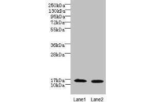 Western blot All lanes: FAM136A antibody at 8 μg/mL Lane 1: Hela whole cell lysate Lane 2: Caco-2 whole cell lysate Secondary Goat polyclonal to rabbit IgG at 1/10000 dilution Predicted band size: 16 kDa Observed band size: 16 kDa (FAM136A anticorps  (AA 2-138))